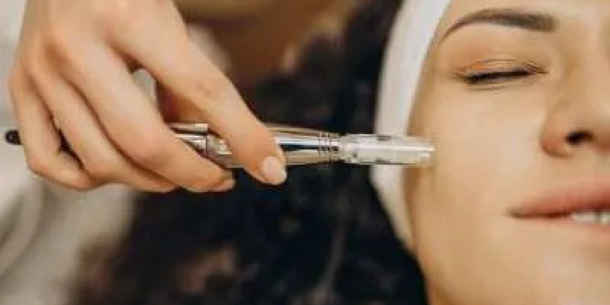 Everything You Need to Know About Fractional Laser Treatment In London