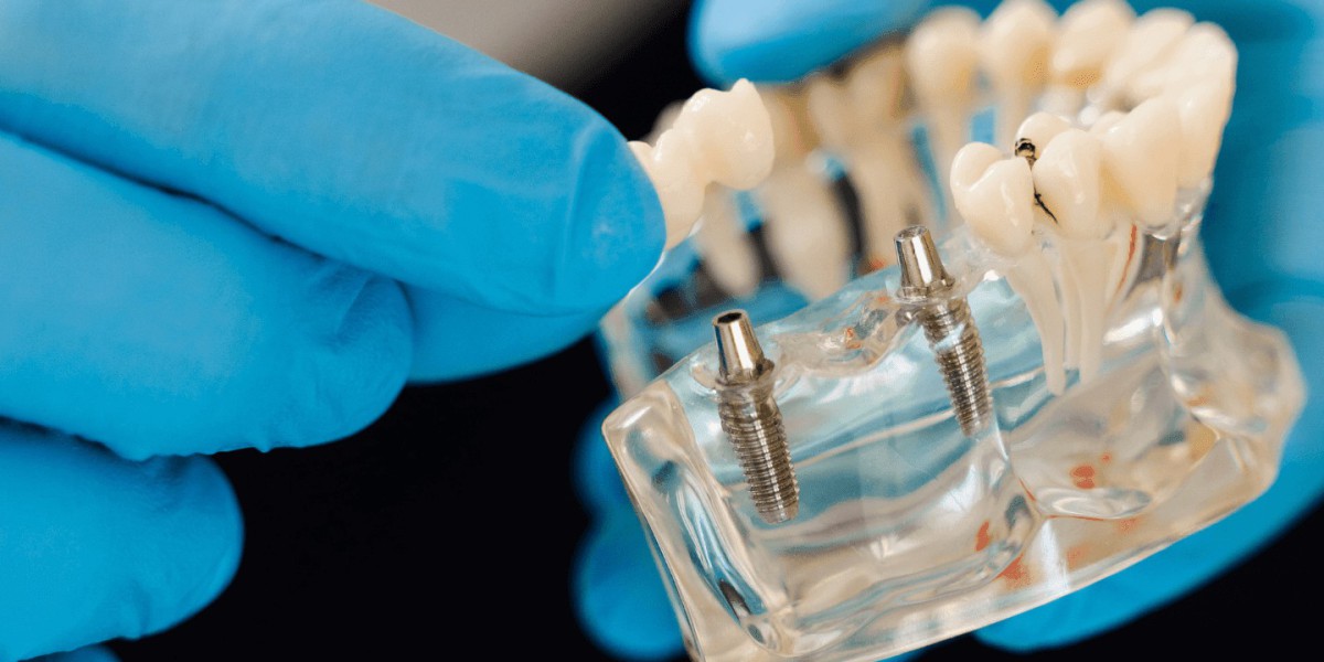 How to Find the Best Dentist in Temecula
