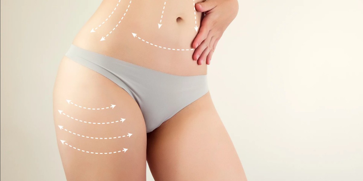 Excellence Result with Best Liposuction Surgeon in Dubai
