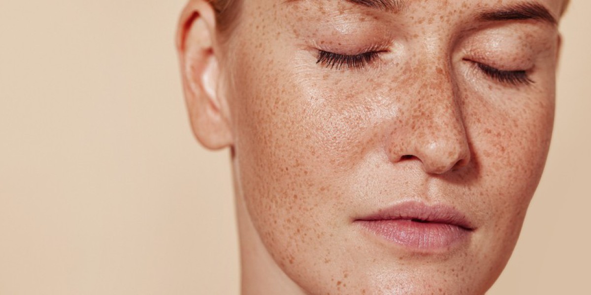 Pigmentation Treatment in Dubai for Different Skin Tones